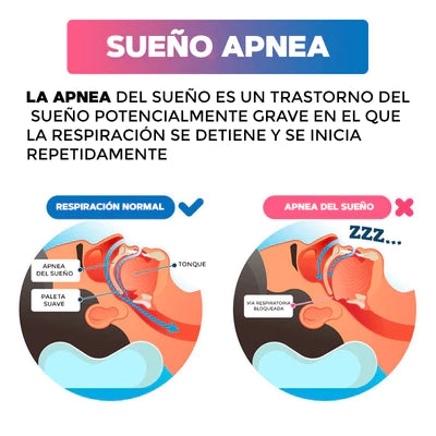 DISPOSITIVO PARA APNEA Y RONQUIDOS